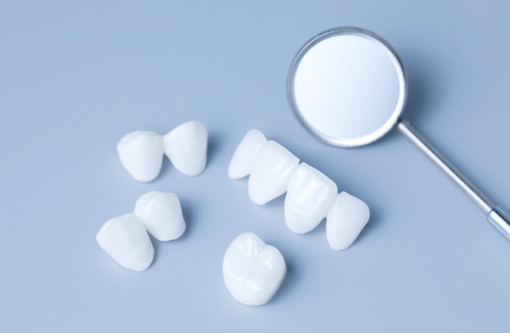Dental Veneers in Oxford, Pennsylvania