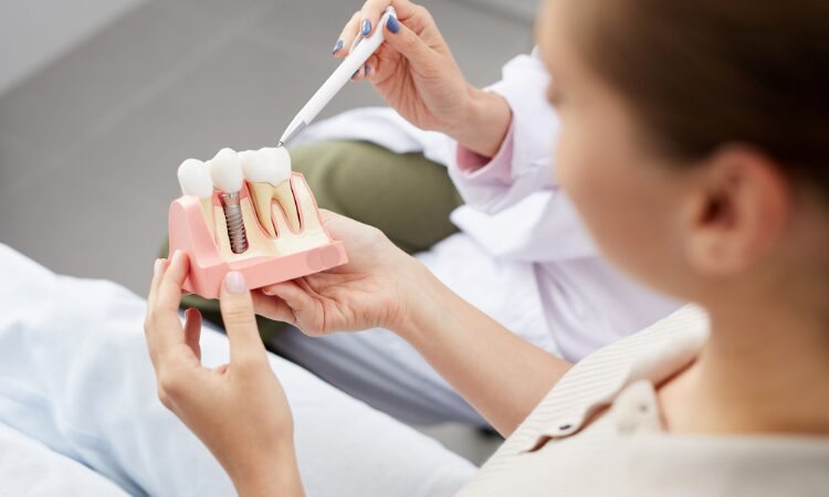 Proper aftercare is essential for ensuring your dental implant integrates properly with the bone and remains stable for years to come.